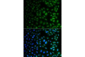 Immunofluorescence analysis of A549 cell using NAA40 antibody. (NAA40 抗体)