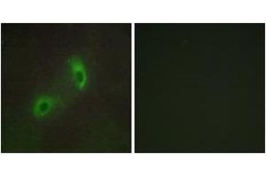 Immunofluorescence analysis of HuvEc cells, using HGS Antibody. (HGS 抗体  (AA 451-500))