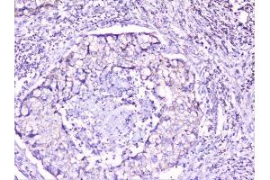 IHC analysis of cortactin using anti-cortactin antibody (ABIN6719306). (Cortactin 抗体  (AA 1-105))