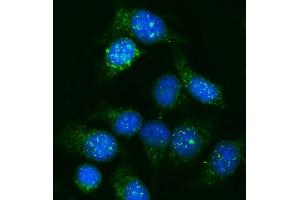IF analysis of GNAL using anti-GNAL antibody (ABIN7599757).