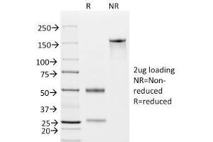 SDS-PAGE Analysis Purified EpCAM Mouse Monoclonal Antibody (EGP40/826). (EpCAM 抗体  (N-Term))