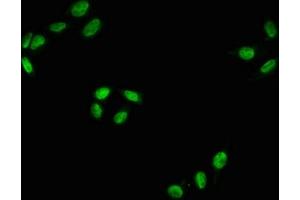 Immunofluorescence staining of Hela with ABIN7127738 at 1:100,counter-stained with DAPI. (Recombinant RAF1 抗体  (pSer43))