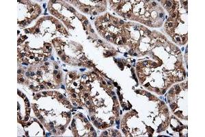 Immunohistochemical staining of paraffin-embedded liver tissue using anti-NPR3mouse monoclonal antibody. (NPR3 抗体)