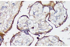 Immunohistochemistry of paraffin-embedded Human placenta using SLC7A2 Polyclonal Antibody at dilution of 1:100 (40x lens). (SLC7A2 抗体)