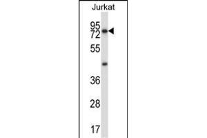 MCOLN1 Antibody (C-term) (ABIN657474 and ABIN2846502) western blot analysis in Jurkat cell line lysates (35 μg/lane). (MCOLN1 抗体  (C-Term))