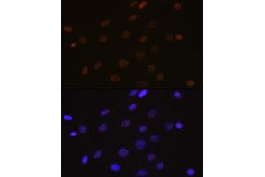 Immunofluorescence analysis of C6 cells using DEK Rabbit mAb (ABIN7266724) at dilution of 1:100 (40x lens). (DEK 抗体)