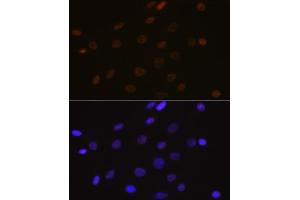 Immunofluorescence analysis of C6 cells using DEK Rabbit mAb (ABIN7266724) at dilution of 1:100 (40x lens).