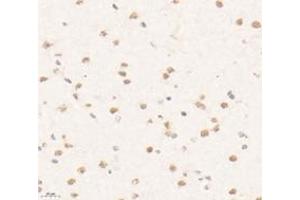 Immunohistochemistry analysis of paraffin-embedded mouse brain using,PRR14 (ABIN7075196) at dilution of 1: 3200 (PRR14 抗体)