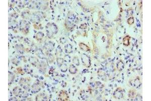 Immunohistochemistry of paraffin-embedded human salivary gland tissue using ABIN7157845 at dilution of 1:100 (EPM2A 抗体  (AA 244-331))