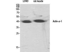 Western Blotting (WB) image for anti-Actin, alpha 1, Skeletal Muscle (ACTA1) (N-Term) antibody (ABIN3183158)
