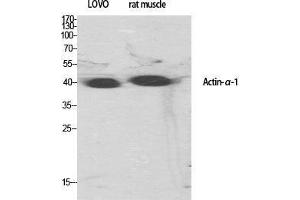 Western Blot (WB) analysis of specific cells using Actin alpha1 Polyclonal Antibody. (Actin 抗体  (N-Term))