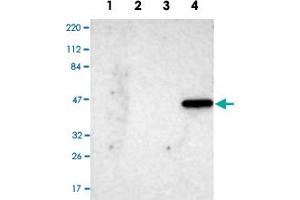 Western Blot analysis of Lane 1: RT-4 cell, Lane 2: U-251 MG sp cell, Lane 3: human plasma tissue (IgG/HSA depleted) and Lane 4: human liver tissue lysates with IL17RB polyclonal antibody . (IL17 Receptor B 抗体)