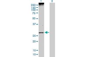 Western Blotting (WB) image for anti-Pleckstrin Homology-Like Domain, Family A, Member 1 (PHLDA1) (AA 1-259) antibody (ABIN524782)
