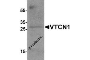 Western Blotting (WB) image for anti-V-Set Domain Containing T Cell Activation Inhibitor 1 (VTCN1) antibody (ABIN1077428) (VTCN1 抗体)