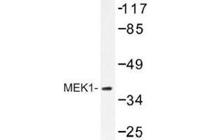 Image no. 1 for anti-Mitogen-Activated Protein Kinase Kinase 1 (MAP2K1) antibody (ABIN317881) (MEK1 抗体)