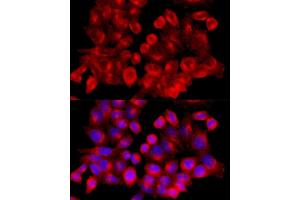 Immunofluorescence analysis of HeLa cells using Clathrin heavy chain antibody (ABIN6131586, ABIN6138752, ABIN6138754 and ABIN6216041) at dilution of 1:100 (40x lens). (Clathrin Heavy Chain (CLTC) (AA 1451-1675) 抗体)
