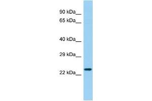 Host: Rabbit Target Name: LHFPL4 Sample Type: Fetal Heart lysates Antibody Dilution: 1. (LHFPL4 抗体  (C-Term))