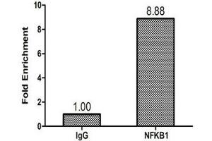 Chromatin Immunoprecipitation Hela (1.