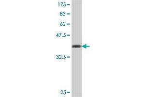 Western Blot detection against Immunogen (37 KDa) . (GEMIN4 抗体  (AA 959-1057))