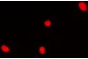 Immunofluorescent analysis of DDX41 staining in Hela cells. (DDX41 抗体)