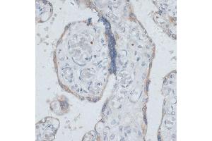 Immunohistochemistry of paraffin-embedded human placenta using DTNBP1 antibody (ABIN7266870) at dilution of 1:100 (40x lens). (DTNBP1 抗体  (AA 1-351))