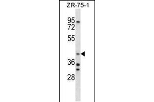 Western blot analysis in ZR-75-1 cell line lysates (35ug/lane). (AIP 抗体  (C-Term))