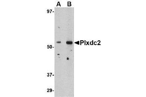 Image no. 1 for anti-Plexin Domain Containing 2 (PLXDC2) (N-Term) antibody (ABIN1494345) (PLXDC2 抗体  (N-Term))