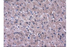 Immunohistochemical staining of paraffin-embedded liver tissue using anti-L1CAMmouse monoclonal antibody. (L1CAM 抗体)