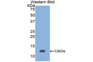 Western blot analysis of the recombinant protein. (PEX2 抗体  (AA 28-118))