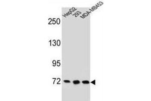 Western Blotting (WB) image for anti-Zinc Finger Protein 860 (ZNF860) antibody (ABIN2996352) (ZNF860 抗体)