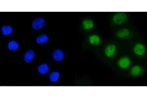 IF analysis of RAD21 using anti-RAD21 antibody (ABIN7601152).