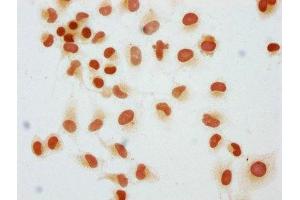Immunocytochemistry analysis of ABIN7139603 diluted at 1:25 and staining in Hela cells performed on a Leica BondTM system. (HIST1H1C 抗体  (meLys45))