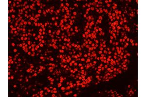 Immunofluorescence (IF) image for anti-Splicing Factor Proline/glutamine-Ric (SFPQ) (AA 657-707) antibody (ABIN7449003) (SFPQ 抗体  (AA 657-707))