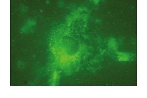 Immunofluorescence (IF) image for anti-Lysosomal-Associated Membrane Protein 2 (LAMP2) antibody (ABIN7211532) (LAMP2 抗体)