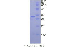 SDS-PAGE analysis of Human Cathepsin C Protein. (CTSC 蛋白)