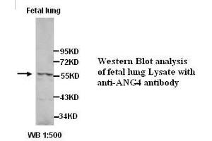Image no. 1 for anti-Angiopoietin 4 (ANGPT4) (Internal Region) antibody (ABIN791095) (Angiopoietin 4 抗体  (Internal Region))