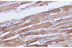 Immunohistochemistry of paraffin-embedded Rat heart using NDUFB7 Polyclonal Antibody at dilution of 1:100 (40x lens). (NDUFB7 抗体)
