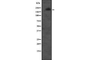 Western blot analysis of CUL7 expression in Molt-4 cell lysate ;,The lane on the left is treated with the antigen-specific peptide. (Cullin 7 抗体  (C-Term))