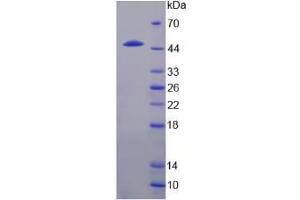 SDS-PAGE analysis of IL24 Protein. (IL-24 蛋白)