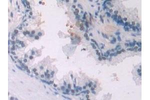 Detection of ENG in Human Prostate Tissue using Polyclonal Antibody to Endoglin (ENG)
