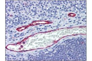 Human Thymus, Vessels: Formalin-Fixed, Paraffin-Embedded (FFPE) (DARC 抗体  (N-Term))