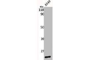 Western Blot analysis of A549 cells using Caveolin-1 Polyclonal Antibody (Caveolin-1 抗体  (C-Term))