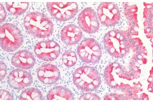 Immunohistochemistry (Paraffin-embedded Sections) (IHC (p)) image for anti-Keratin 19 (KRT19) antibody (ABIN94288)