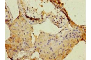 Immunohistochemistry of paraffin-embedded human testis tissue using ABIN7150689 at dilution of 1:100 (DUOX1 抗体  (AA 1312-1551))
