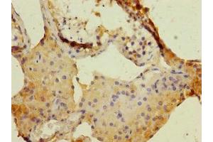 Immunohistochemistry of paraffin-embedded human testis tissue using ABIN7150689 at dilution of 1:100 (DUOX1 抗体  (AA 1312-1551))