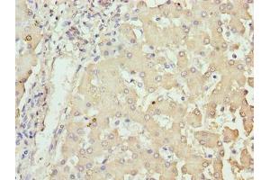 Immunohistochemistry of paraffin-embedded human liver tissue using ABIN7162026 at dilution of 1:100 (NUPL2 抗体  (AA 1-224))