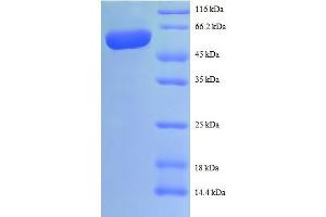 SDS-PAGE (SDS) image for Interleukin 12 beta (IL12B) (AA 23-328) protein (GST tag) (ABIN5712492) (IL12B Protein (AA 23-328) (GST tag))
