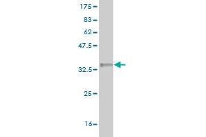 Western Blot detection against Immunogen (35. (LYPLA2 抗体  (AA 144-231))