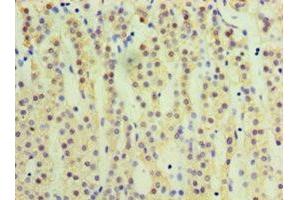 Immunohistochemistry (IHC) image for anti-Cytochrome P450, Family 17, Subfamily A, Polypeptide 1 (CYP17A1) (AA 24-508) antibody (ABIN7170753)
