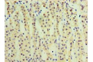 Immunohistochemistry of paraffin-embedded human adrenal gland tissue using ABIN7170753 at dilution of 1:100 (CYP17A1 抗体  (AA 24-508))